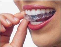  Bruxism Treatments